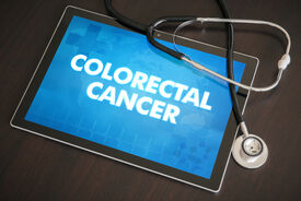 Colorectal cancer awareness